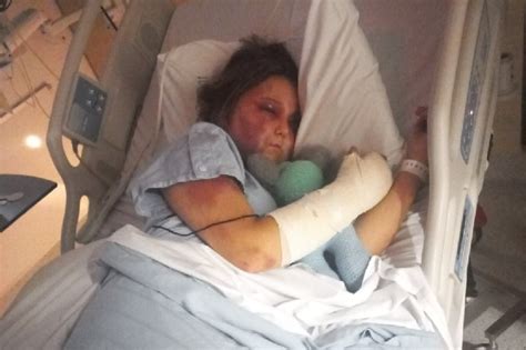 kirra getting bashed|Family’s horror as teen girl bashed, tortured